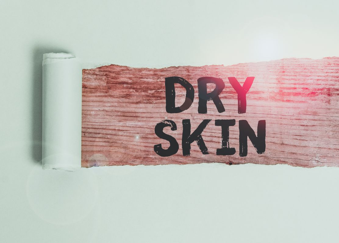 how-to-treat-dry-skin-with-acne-s-nd